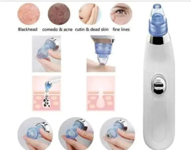 DermaSuction Blackhead Remover