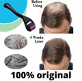 Your Secret Weapon for Thicker, Healthier Hair / Derma Roller